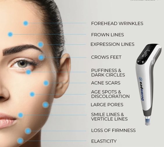 Dermapen 4 product