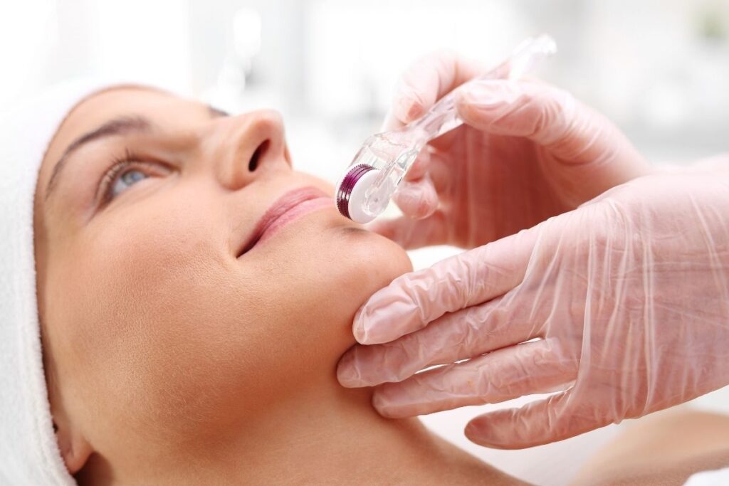 Lady getting Micro Needling for acne at The Roxbury Institute in Beverly Hills