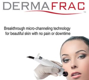 Dermafrac Treatment